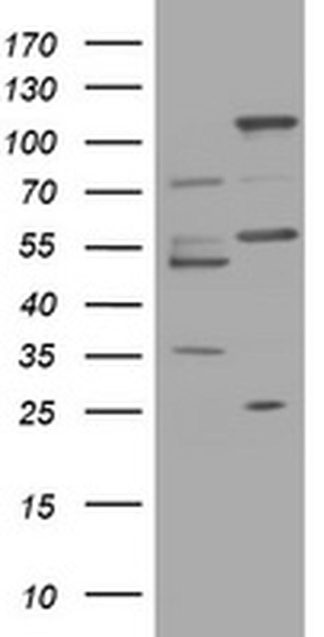 TRAPPC4 Antibody in Western Blot (WB)