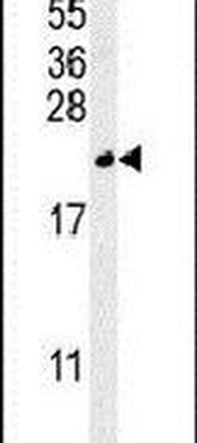 TREM2 Antibody in Western Blot (WB)