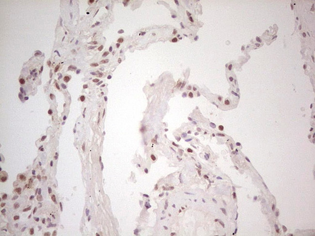 TRIB1 Antibody in Immunohistochemistry (Paraffin) (IHC (P))