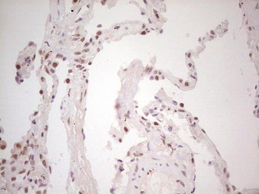 TRIB1 Antibody in Immunohistochemistry (Paraffin) (IHC (P))