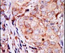 TRIB3 Antibody in Immunohistochemistry (IHC)