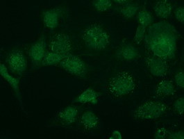 TRIM2 Antibody in Immunocytochemistry (ICC/IF)