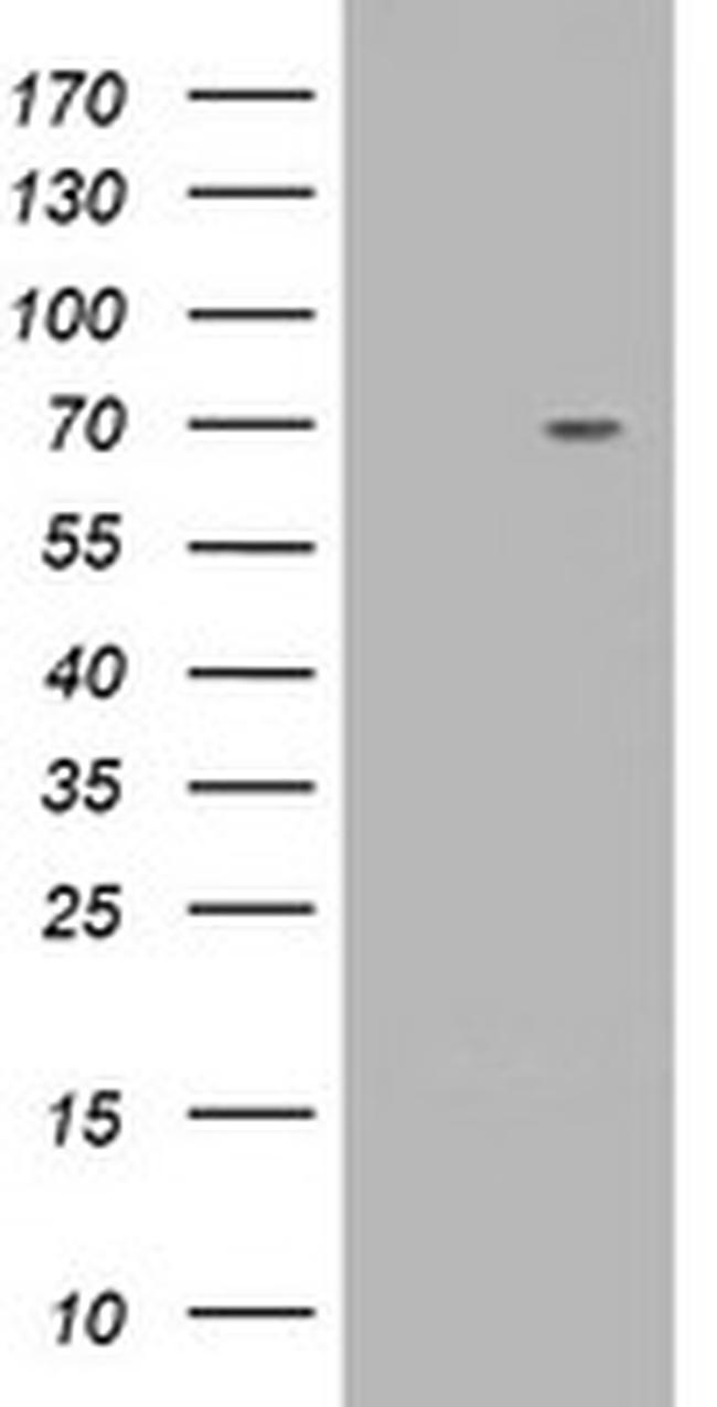 TRIM2 Antibody in Western Blot (WB)