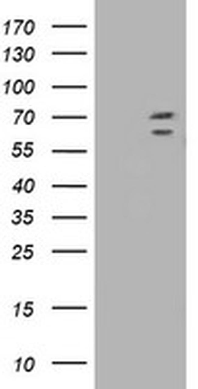 TRIM2 Antibody in Western Blot (WB)