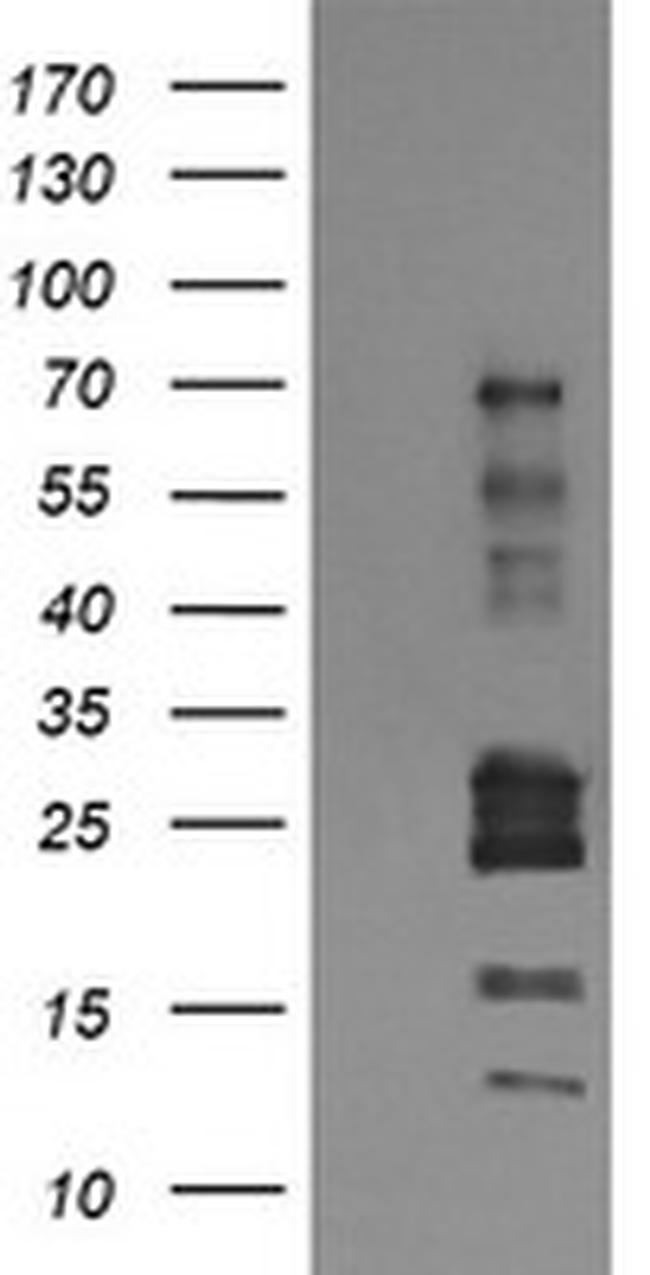 TRIM22 Antibody in Western Blot (WB)