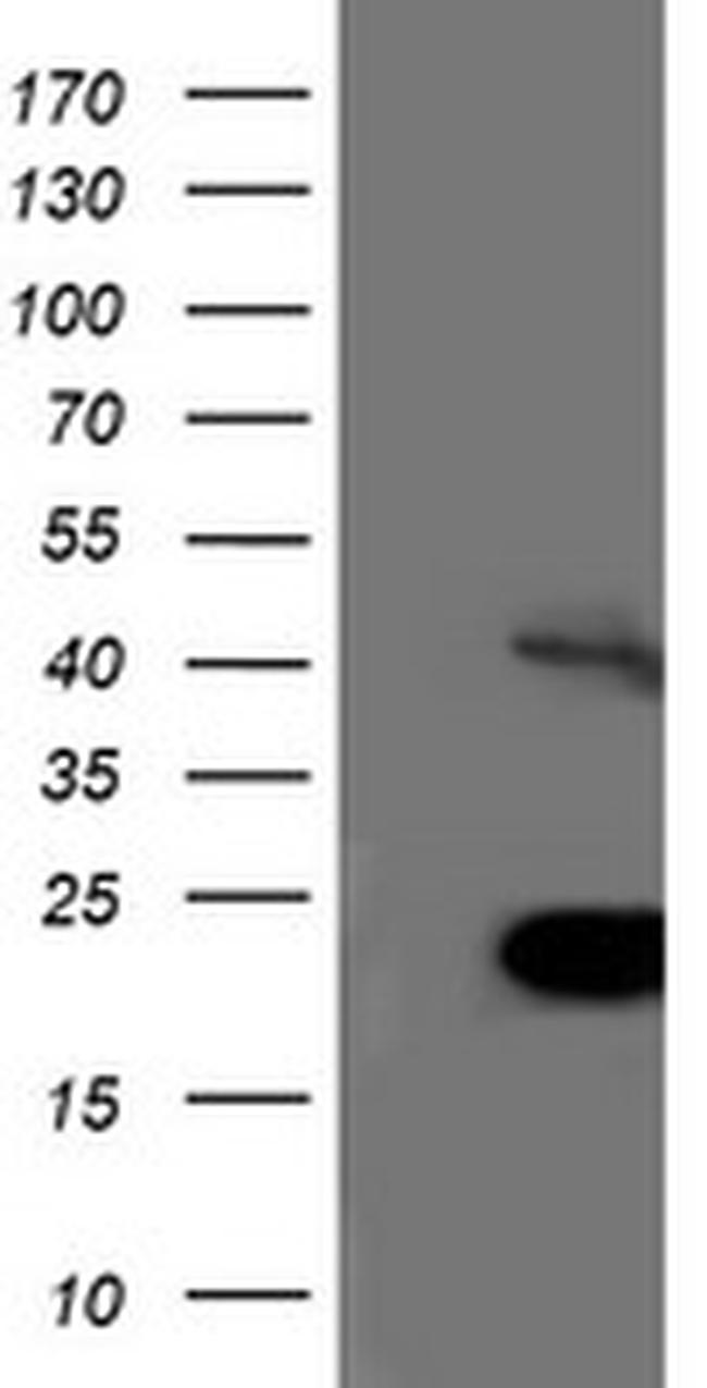 TRIM24 Antibody in Western Blot (WB)