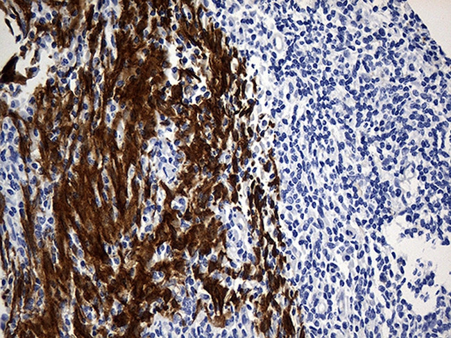 TRIM29 Antibody in Immunohistochemistry (Paraffin) (IHC (P))