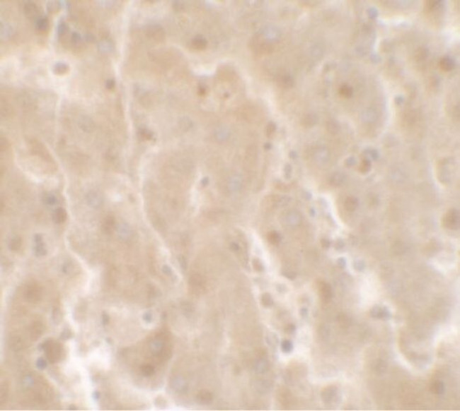TRIM33 Antibody in Immunohistochemistry (IHC)