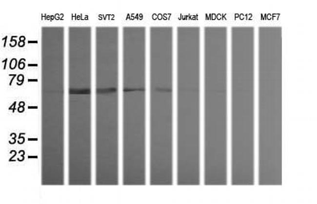 TRIM38 Antibody in Western Blot (WB)