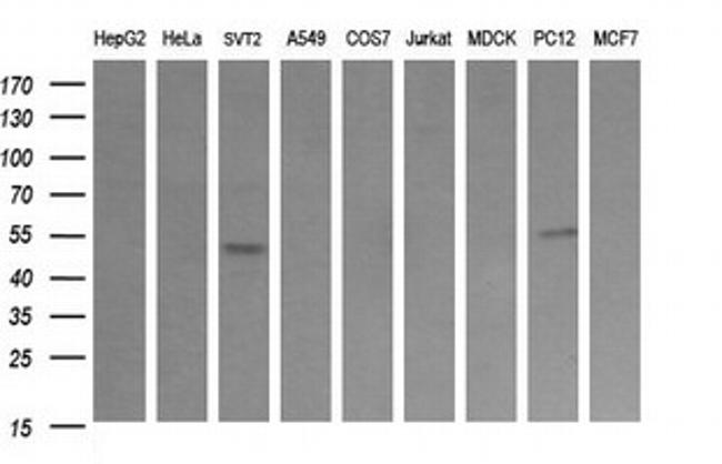 TRIM38 Antibody in Western Blot (WB)