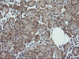 TRIM44 Antibody in Immunohistochemistry (Paraffin) (IHC (P))