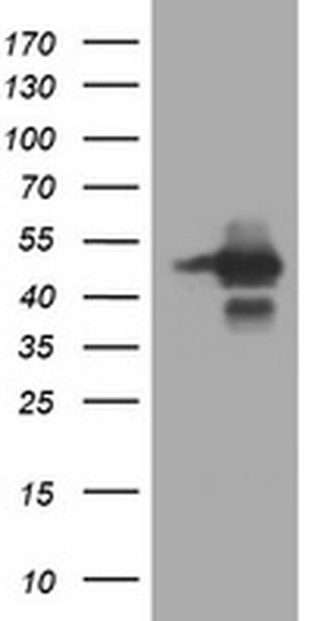 TRIM44 Antibody in Western Blot (WB)