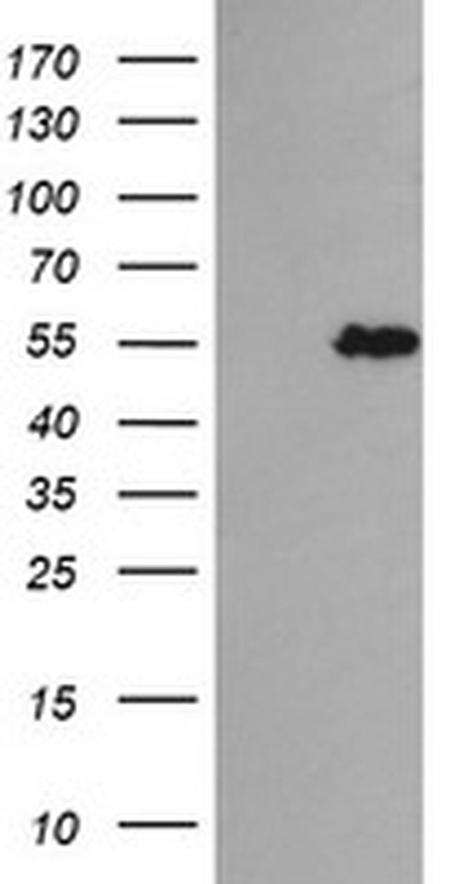 TRIM44 Antibody in Western Blot (WB)