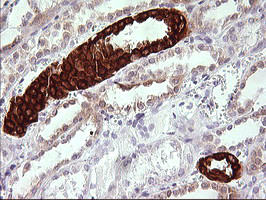 TRIM45 Antibody in Immunohistochemistry (Paraffin) (IHC (P))