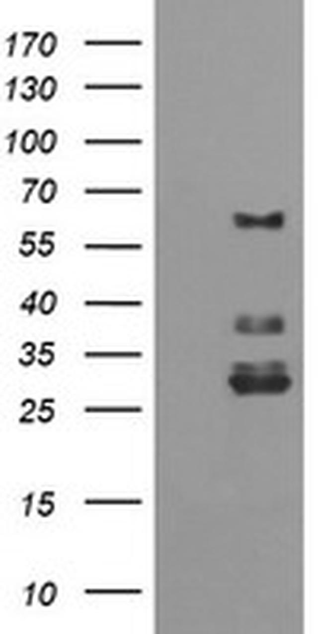 TRIM45 Antibody in Western Blot (WB)