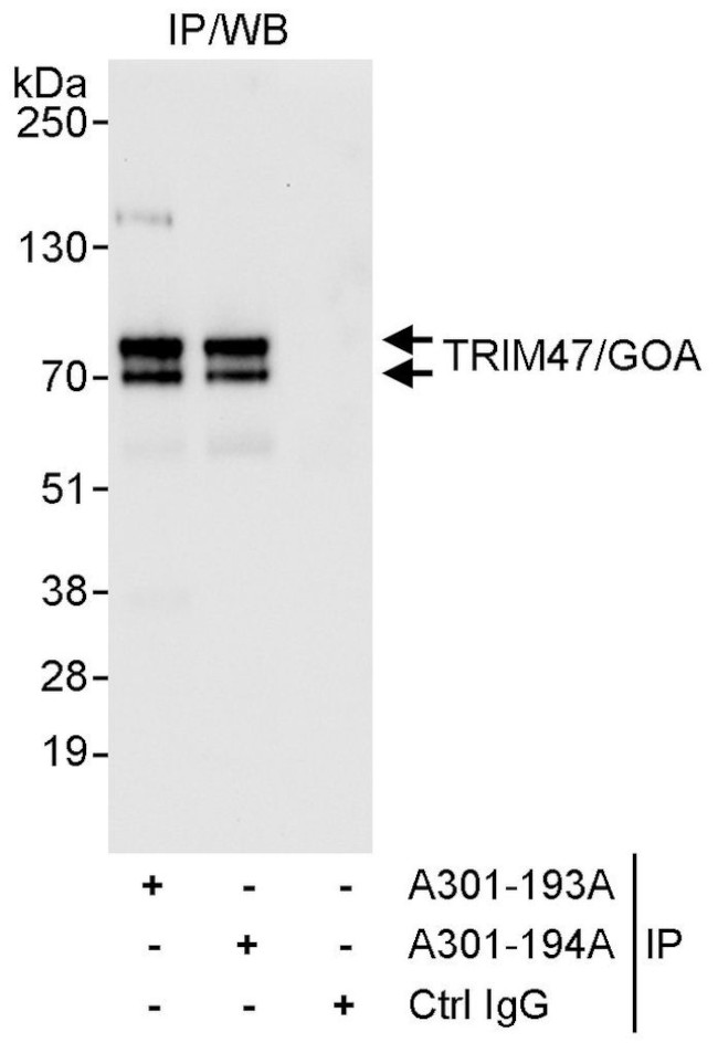 TRIM47/GOA Antibody in Immunoprecipitation (IP)