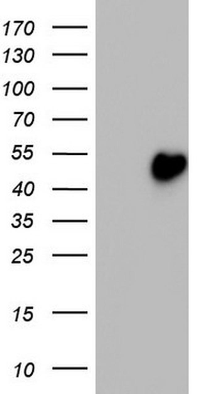 TRIM54 Antibody in Western Blot (WB)