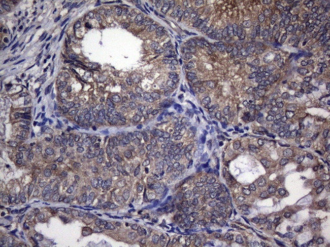TRIM56 Antibody in Immunohistochemistry (Paraffin) (IHC (P))