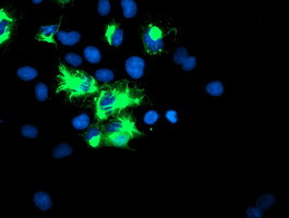 TRIM9 Antibody in Immunocytochemistry (ICC/IF)