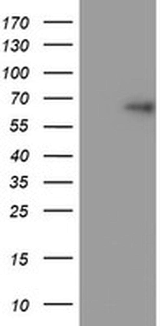TRIM9 Antibody in Western Blot (WB)
