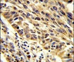 TRIP13 Antibody in Immunohistochemistry (IHC)