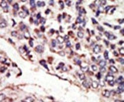 TrkC Antibody in Immunohistochemistry (IHC)