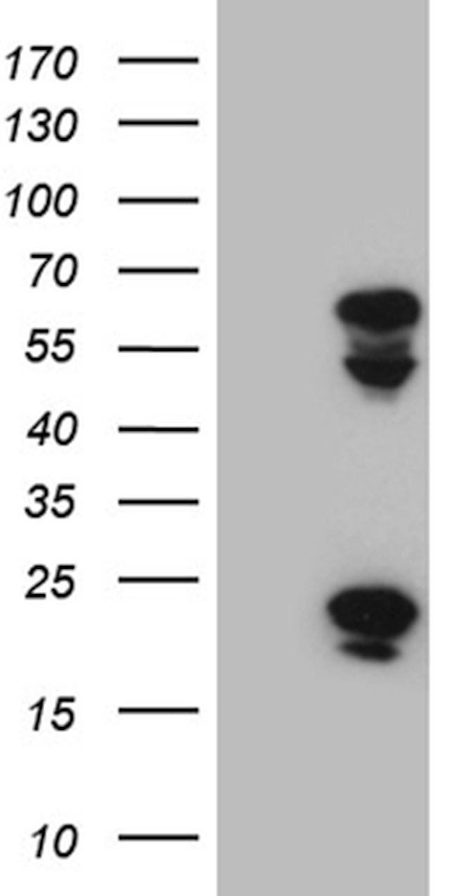 TRMT12 Antibody in Western Blot (WB)