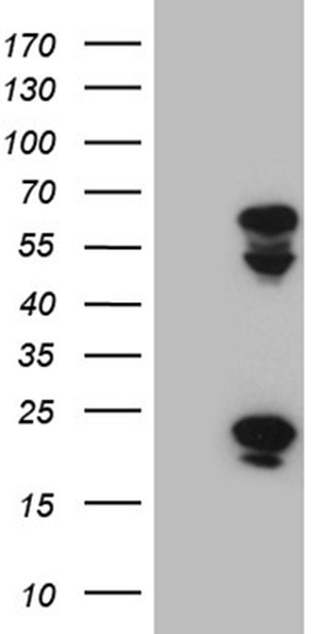 TRMT12 Antibody in Western Blot (WB)