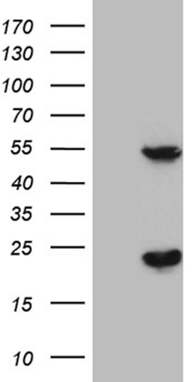 TRMT12 Antibody in Western Blot (WB)