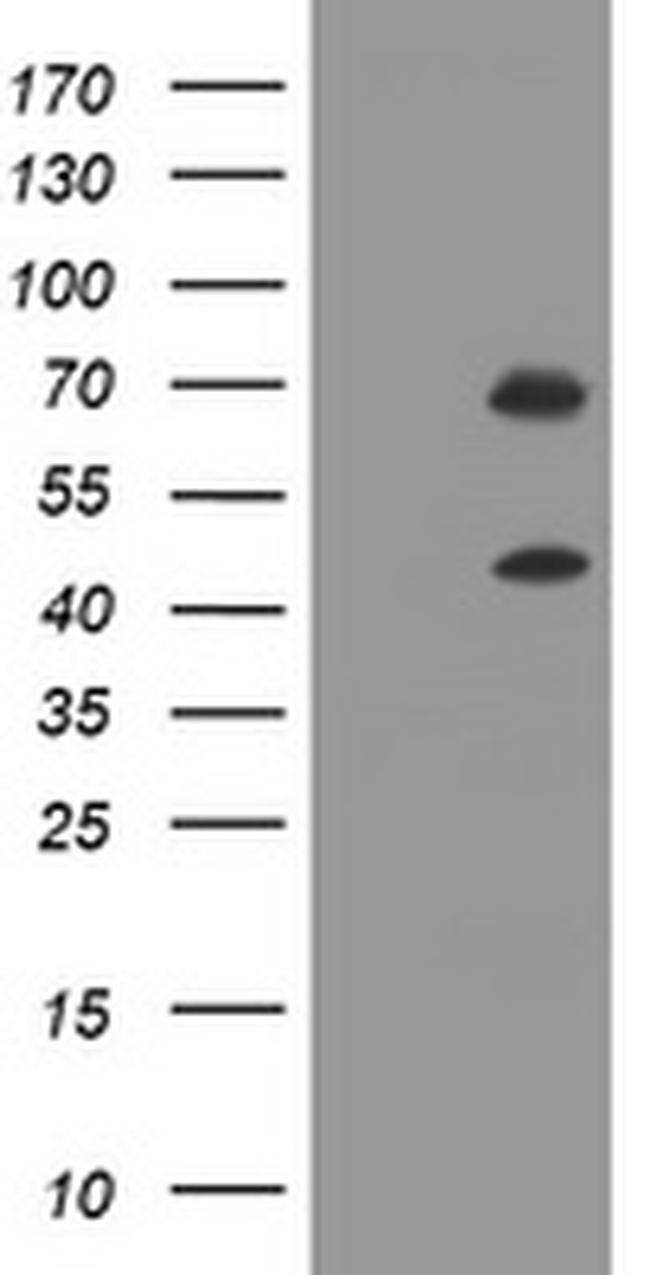 TRMT2A Antibody in Western Blot (WB)