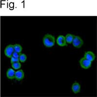 TRPM4 Antibody in Immunocytochemistry (ICC/IF)