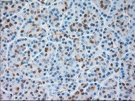 TRPM4 Antibody in Immunohistochemistry (Paraffin) (IHC (P))