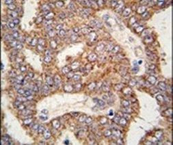 TRPM8 Antibody in Immunohistochemistry (IHC)
