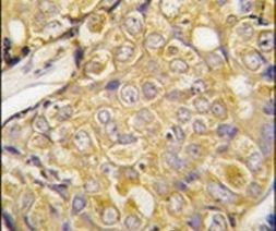 TRPM8 Antibody in Immunohistochemistry (IHC)