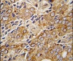 TRPM8 Antibody in Immunohistochemistry (IHC)