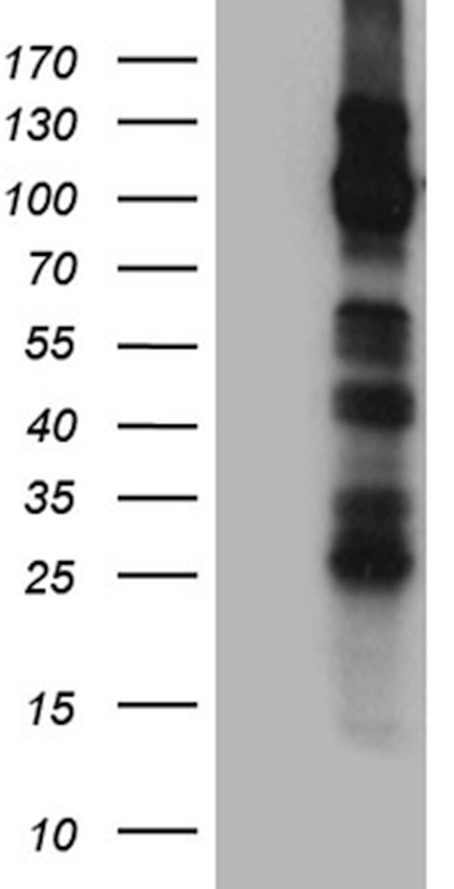 TRPM8 Antibody in Western Blot (WB)