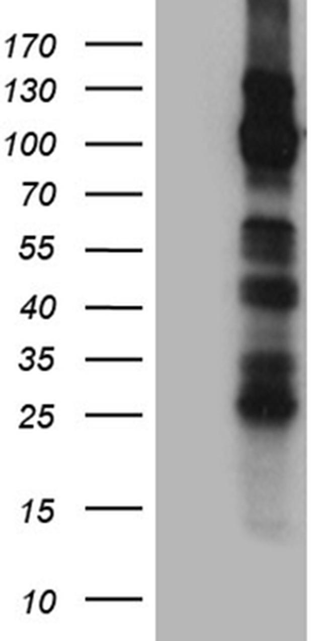 TRPM8 Antibody in Western Blot (WB)