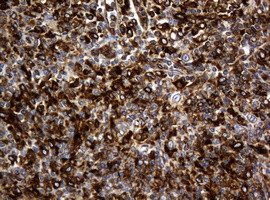TSC22D1 Antibody in Immunohistochemistry (Paraffin) (IHC (P))