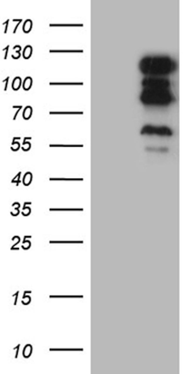 TSHZ1 Antibody in Western Blot (WB)