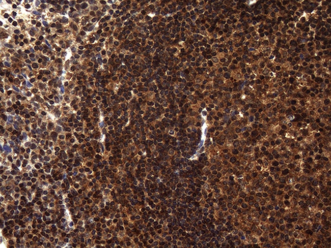 TSN Antibody in Immunohistochemistry (Paraffin) (IHC (P))