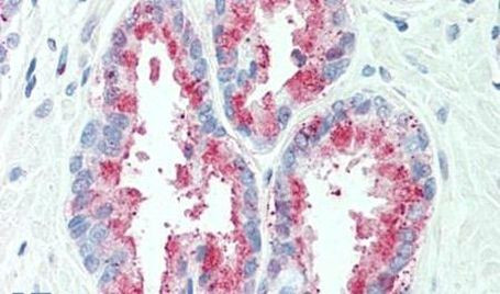TSPAN13 Antibody in Immunohistochemistry (Paraffin) (IHC (P))