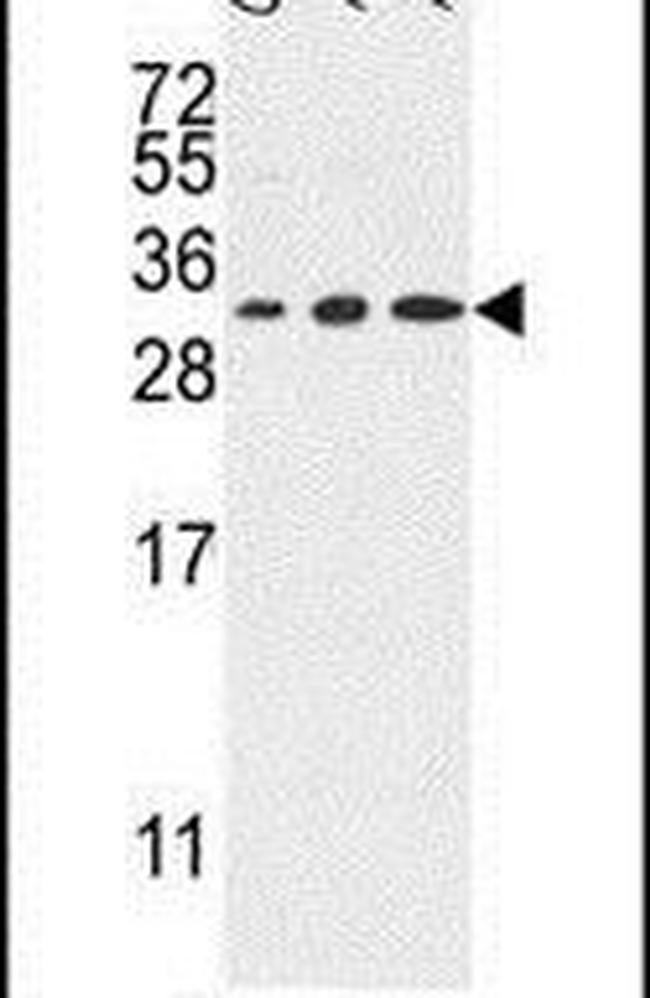 TSPAN2 Antibody in Western Blot (WB)