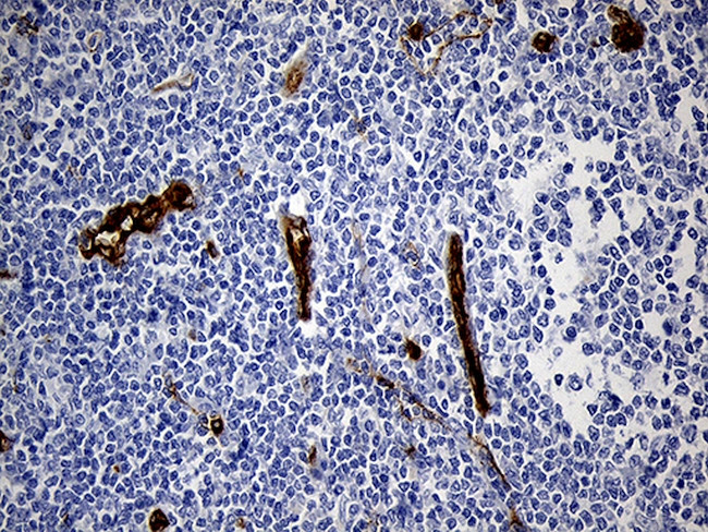 TSPAN7 Antibody in Immunohistochemistry (Paraffin) (IHC (P))
