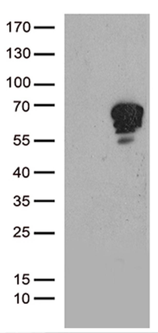 TSPYL1 Antibody in Western Blot (WB)