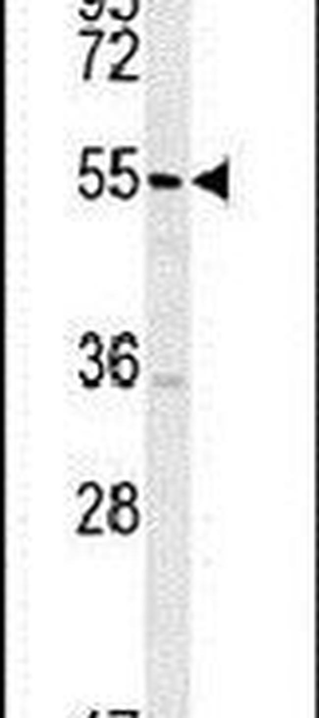 TSPYL4 Antibody in Western Blot (WB)
