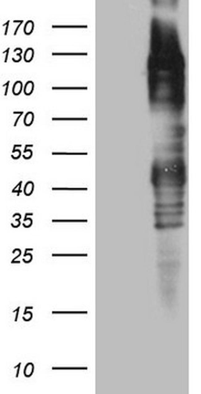 TTC14 Antibody in Western Blot (WB)