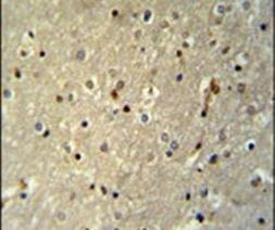 TTC26 Antibody in Immunohistochemistry (IHC)