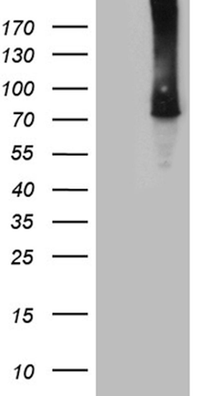 TTC30B Antibody in Western Blot (WB)