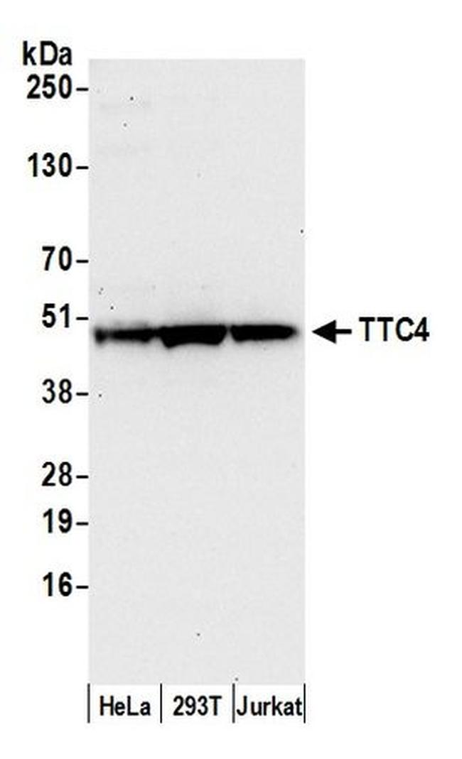 TTC4 Antibody in Western Blot (WB)