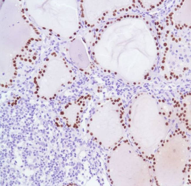 TTF1 Antibody in Immunohistochemistry (IHC)